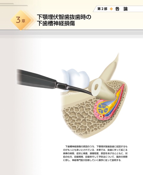 カラーグラフィックス 下歯槽神経・舌神経麻痺 第3版 – 丸善ジュンク堂