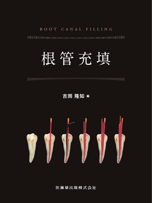 根管充填 – 丸善ジュンク堂書店ネットストア