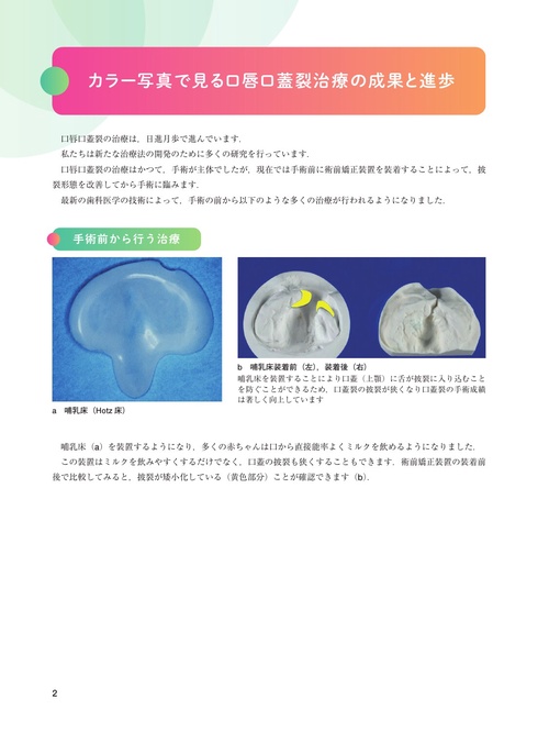 口唇口蓋裂Update – 丸善ジュンク堂書店ネットストア