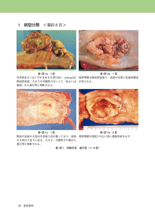臨床・病理 食道癌取扱い規約 第12版 – 丸善ジュンク堂書店ネットストア