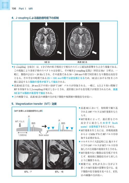 MR・超音波・眼底 基礎知識図解ノート 第2版補訂版 – 丸善ジュンク堂