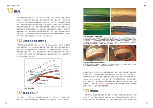 最新 緑内障診療パーフェクトガイドー患者教育から最新の手術治療まで