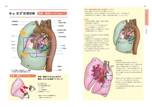 ベクトル視点でやさしく読み解く呼吸器外科手術解剖イラスト – 丸善