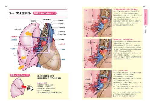 ベクトル視点でやさしく読み解く呼吸器外科手術解剖イラスト – 丸善