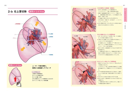 ベクトル視点でやさしく読み解く呼吸器外科手術解剖イラスト – 丸善