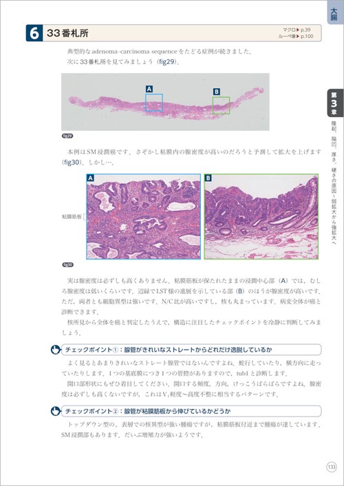 150年前の医学書【華氏病理摘要】ハルツホールン著、折込銅版図入、完本 Dr.ヤンデルの臨床に役立つ消化管病理 – 丸善ジュンク堂書店