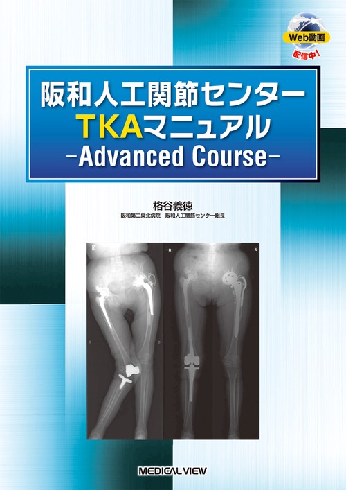 阪和人工関節センター TKAマニュアル Advanced Course – 丸善ジュンク