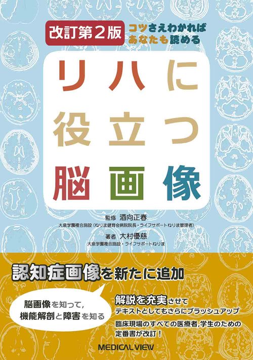 コツさえわかればあなたも読める リハに役立つ脳画像 – 丸善ジュンク堂