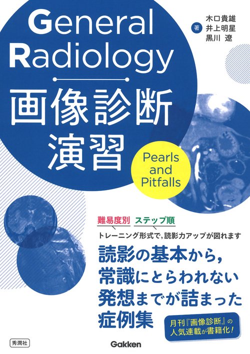 General Radiology画像診断演習 – 丸善ジュンク