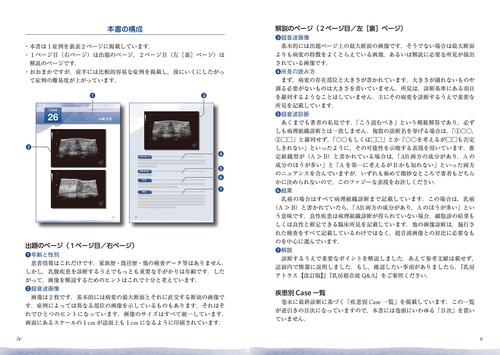 乳房超音波トレーニングブック – 丸善ジュンク堂書店ネットストア
