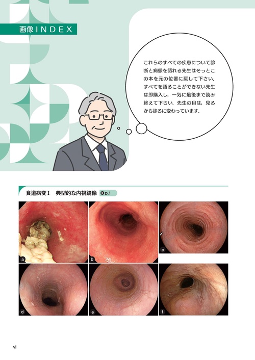 病態を考える！ はるま先生の見るから診るへの内視鏡診断学 – 丸善