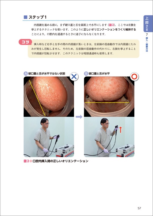 最速で身につける！消化器内視鏡の基本テクニック – 丸善ジュンク堂