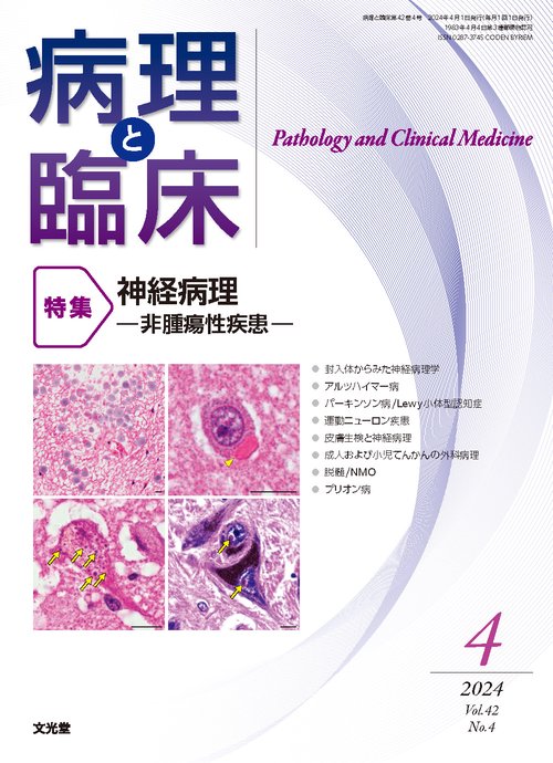 【裁断済】　病理診断に直結した組織学 (病理と臨床 臨時増刊号) ブランド 品 通販本・雑誌・漫画 - 【裁断済】 病理診断に直結