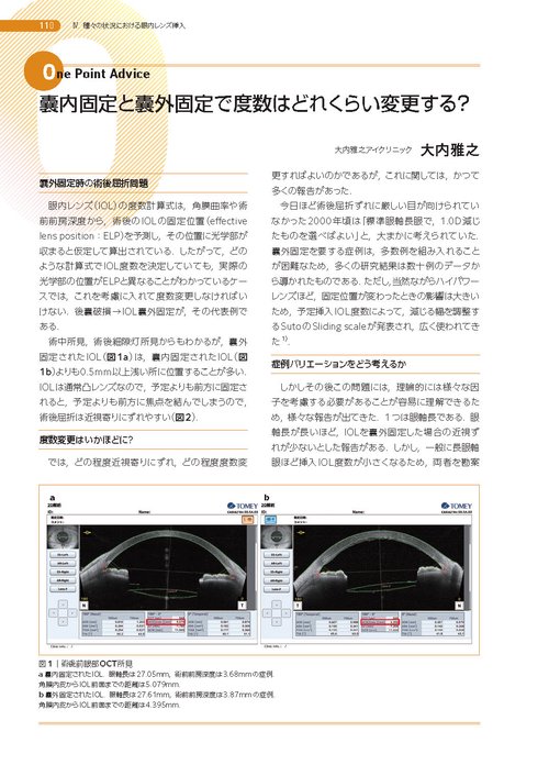 眼内レンズの知識を深める (新篇眼科プラクティス 12) – 丸善ジュンク