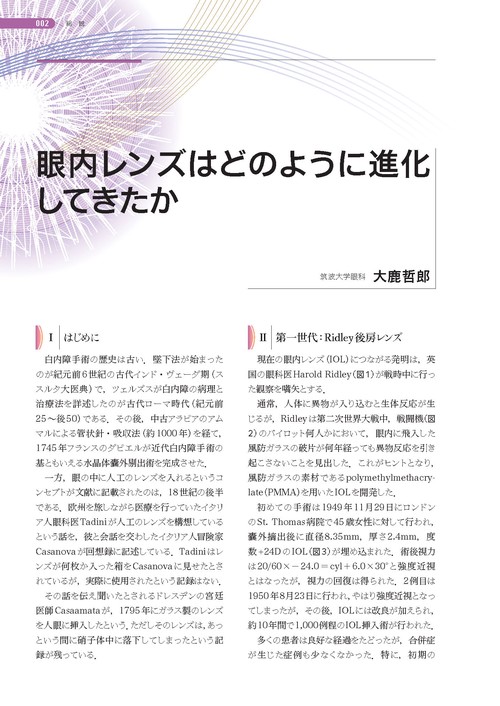 眼内レンズの知識を深める (新篇眼科プラクティス 12) – 丸善ジュンク