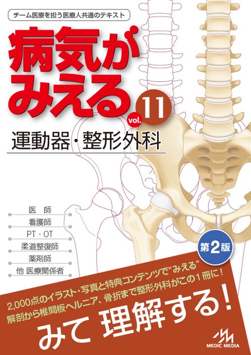 病気がみえる vol.11 運動器・整形外科 (第2版) – 丸善ジュンク