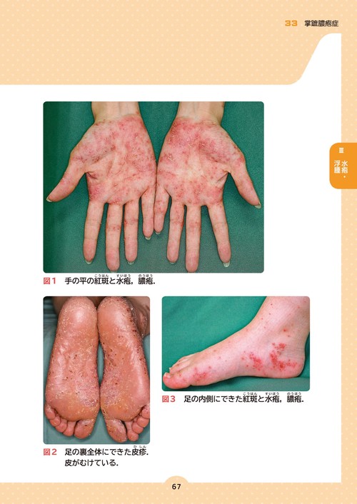 患者説明用 皮膚疾患アトラス 第2版 – 丸善ジュンク堂書店ネットストア