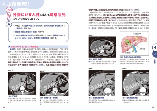 MRI & CT 一問一答セット CT診断一問一答 – 丸善ジュンク堂書店ネットストア