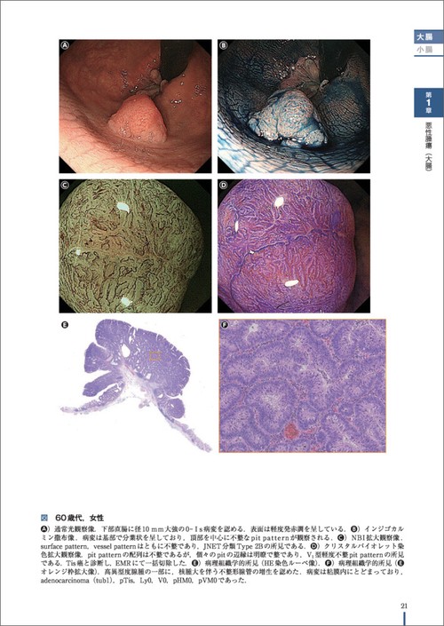 美しい画像で見る内視鏡アトラス 下部消化管 – 丸善ジュンク堂書店
