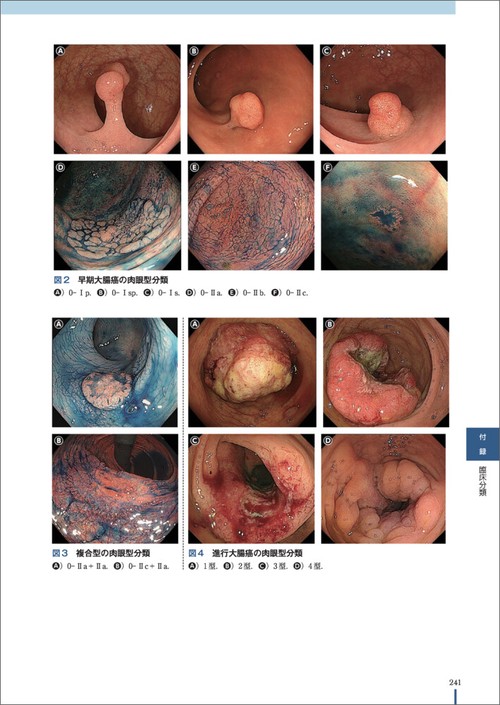 消化管画像強調内視鏡(IEE)アトラス 消化管画像強調内視鏡(IEE)アトラス | 田中信治, 武藤 学, 上堂文也