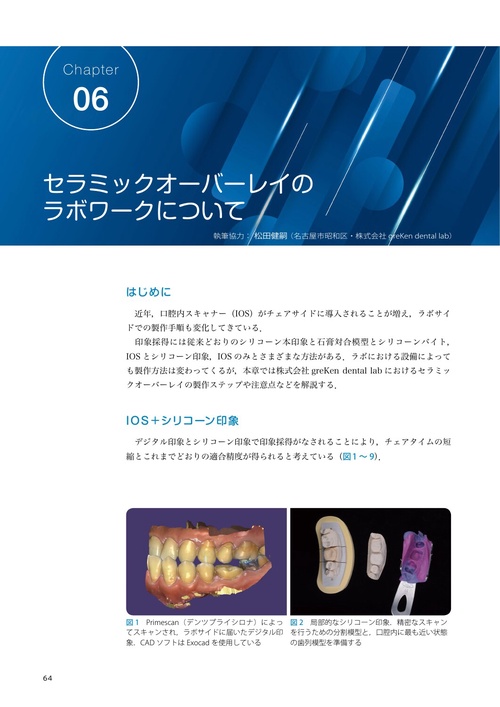 これから始めるセラミックオーバーレイ治療 – 丸善ジュンク堂