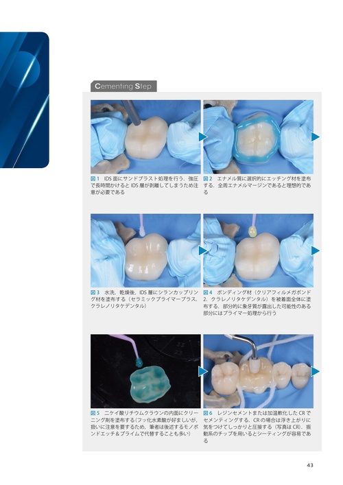 裁断済み　これから始めるセラミックオーバーレイ治療 これから始めるセラミックオーバーレイ治療/医歯薬出版株式会社