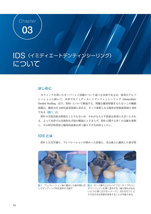 (naoki)セラミックオーバーレイ治療とラバーダムテクニック 61AmElWWrZL._UF350,350_QL80_.jpg