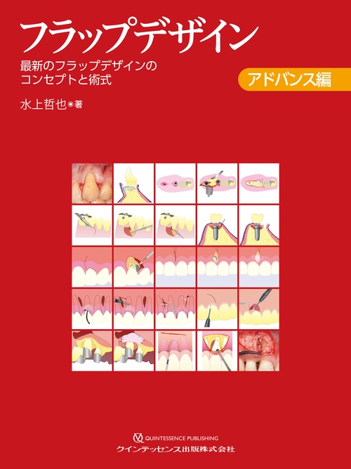 フラップデザイン　アドバンス編　歯科 フラップデザイン アドバンス編 – 丸善ジュンク堂書店ネットストア