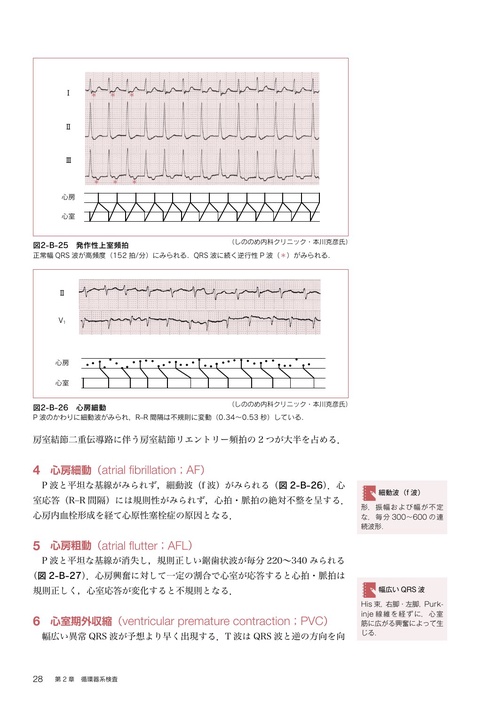 臨床薬理学 筋萎縮性側索硬化症と前頭側頭型認知症の核酸医薬を開発 発症に