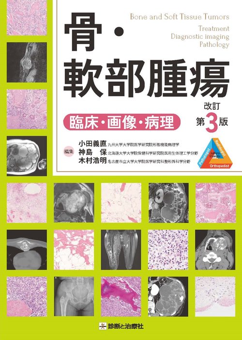 裁断済み　骨・軟部腫瘍 第3版 骨・軟部腫瘍 改訂第3版 – 丸善ジュンク堂書店ネットストア