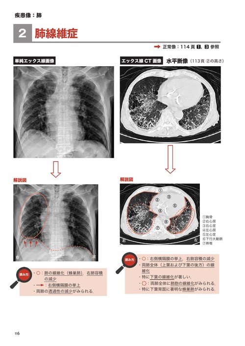 理学療法士・作業療法士 PT・OT基礎から学ぶ画像の読み方第4版 国試