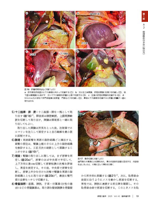 【裁断済み】病理解剖実践ガイドブック2025(病理と臨床 臨時増刊号) 病理と臨床 2025年臨時増刊号【電子版】 | 医書.jp