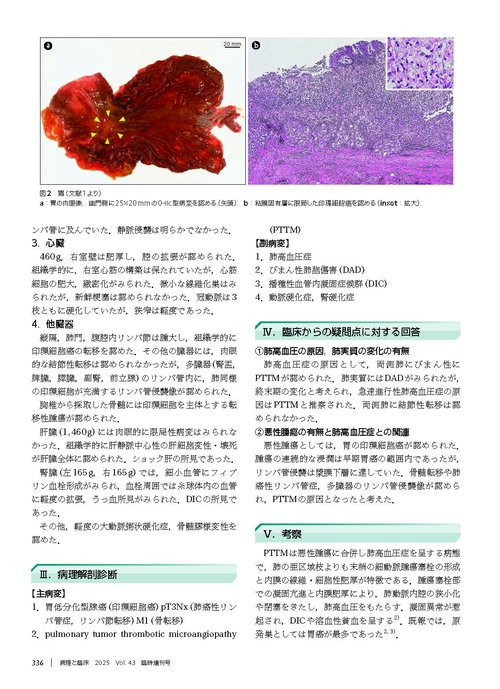 病理と臨床 2025年臨時増刊号（43巻）：【特集】病理解剖実践