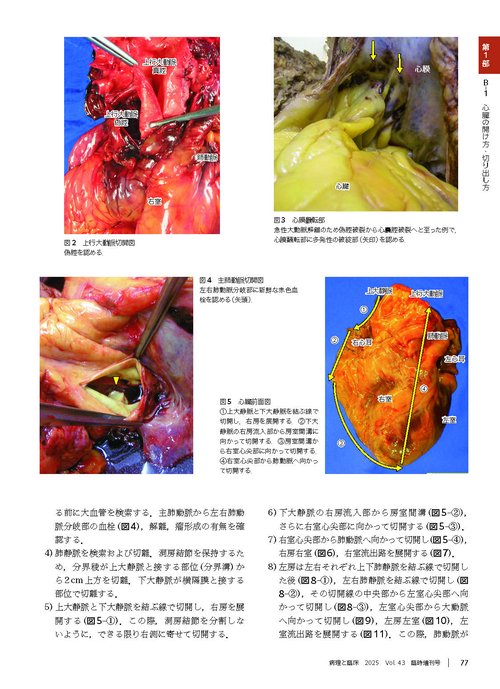 病理と臨床 2025年臨時増刊号（43巻）：【特集】病理解剖実践ガイド