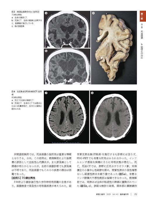 【裁断済】病理解剖実践ガイドブック　2025病理と臨床vol.43 病理と臨床 2025年臨時増刊号（43巻）：【特集】病理解剖実践