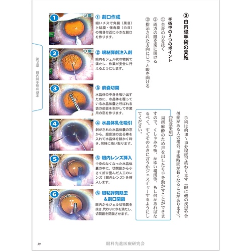 よし、白内障手術を受けよう！ – 丸善ジュンク堂書店ネットストア