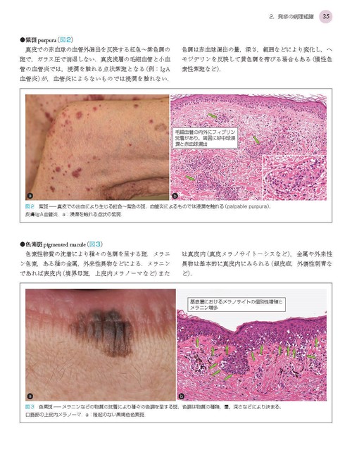 皮膚病理のすべて 1 皮膚病理のすべて I 基礎知識とパターン分類 | 真鍋俊明, 安齋
