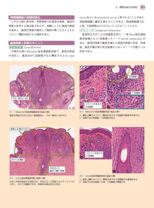 一冊でわかる皮膚病理 1冊でわかる皮膚病理 第2版 (皮膚科サブスペシャリティー