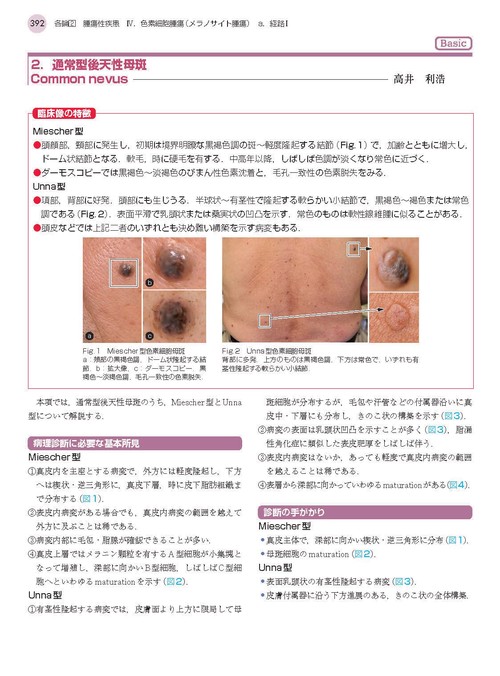 1冊でわかる皮膚病理 第2版 (皮膚科サブスペシャリティーシリーズ