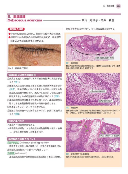 1冊でわかる皮膚病理 第2版 (皮膚科サブスペシャリティー