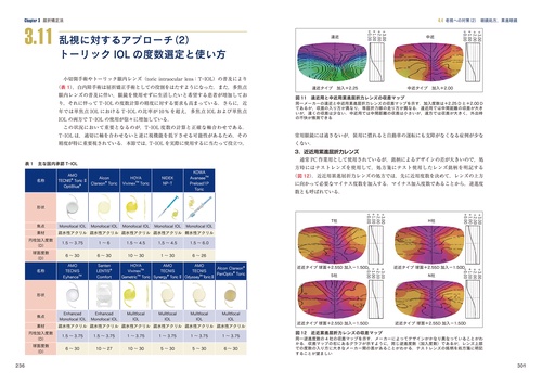屈折異常と矯正 屈折異常(近視・遠視・乱視)とは -治療法や矯正方法の種類や特徴