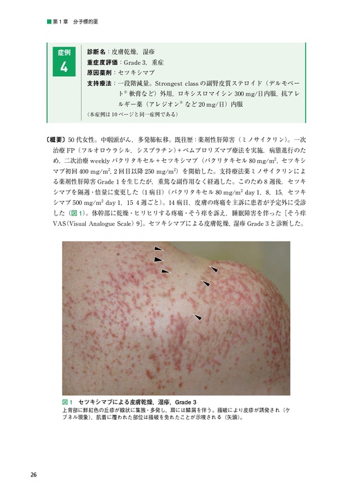 裁断済　がん患者の皮膚障害アトラス　宇原久 Amazon.co.jp: がん患者の皮膚障害アトラス : 宇原 久: 本