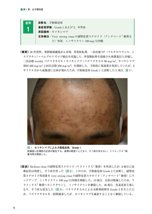 【裁断済】がん患者の皮膚障害アトラス Amazon.co.jp: がん患者の皮膚障害アトラス : 宇原 久: 本