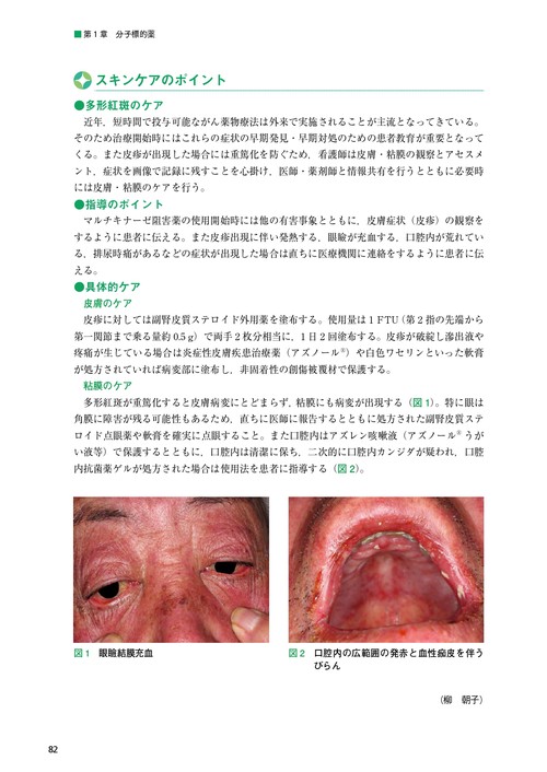 裁断済　がん患者の皮膚障害アトラス　宇原久 Amazon.co.jp: がん患者の皮膚障害アトラス : 宇原 久: 本