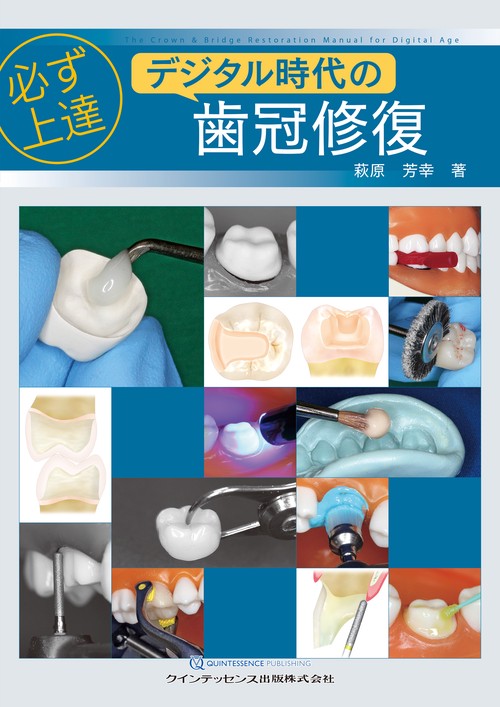 必ず上達 デジタル時代の歯冠修復 – 丸善ジュンク堂書店ネットストア