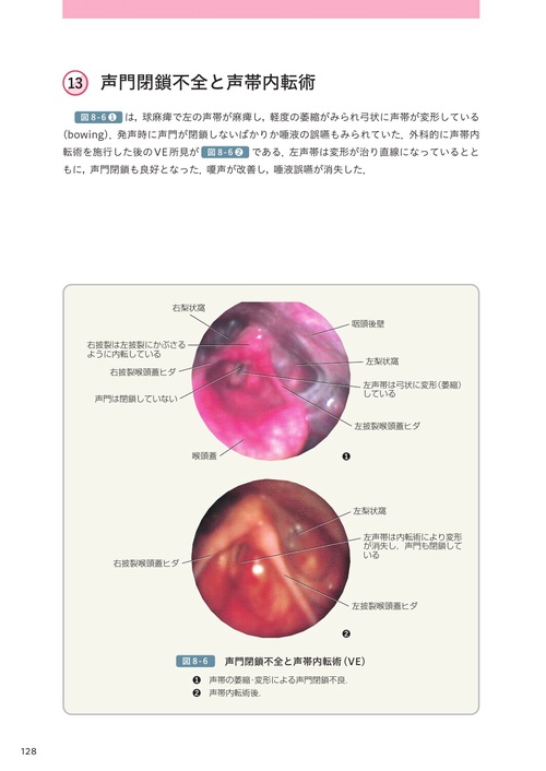 実践嚥下内視鏡検査(VE) 動画でみる嚥下診療マニュアル Amazon.co.jp: 実践嚥下内視鏡検査(VE): 動画でみる嚥下診療
