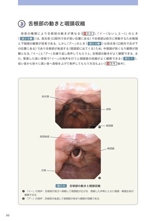 実践嚥下内視鏡検査(VE) 動画でみる嚥下診療マニュアル Amazon.co.jp: 実践嚥下内視鏡検査(VE): 動画でみる嚥下診療