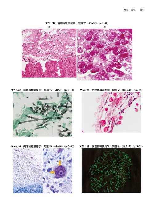 臨床検査技師国家試験問題集 2026年版 オンラインテスト／第67