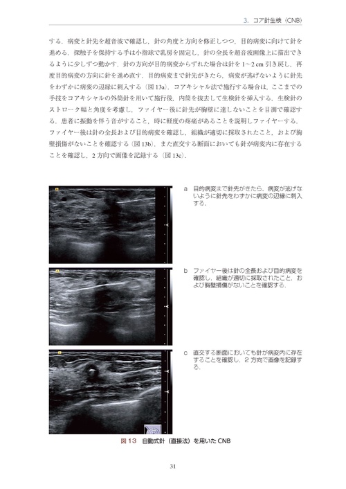 乳房超音波ガイド下針生検マニュアル［Web動画付き］ 細胞診から吸引式