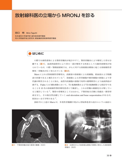 歯科医院必携 臨床医のための薬剤関連顎骨壊死の本 – 丸善ジュンク堂